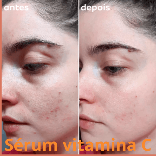 Box pele bela  |  Sérum Vitamina C + Sérum Rosa mosqueta