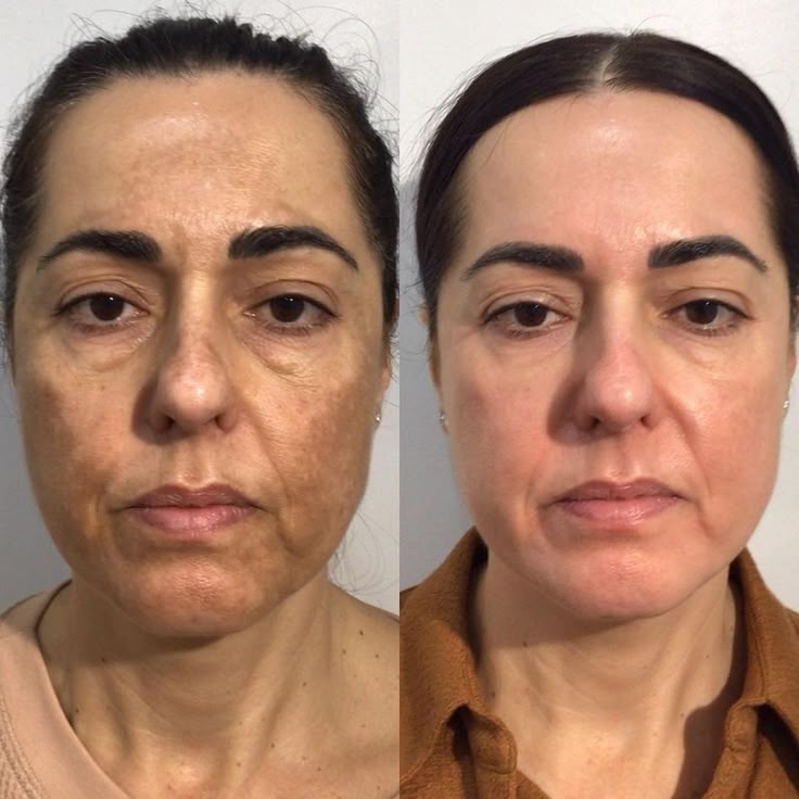 Kahi Nature Regenera Pro-Age