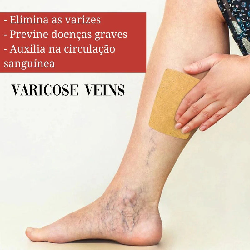 Varicose™ – Adesivo Redutor de Vasos