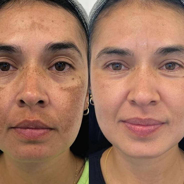 Kahi Nature Regenera Pro-Age