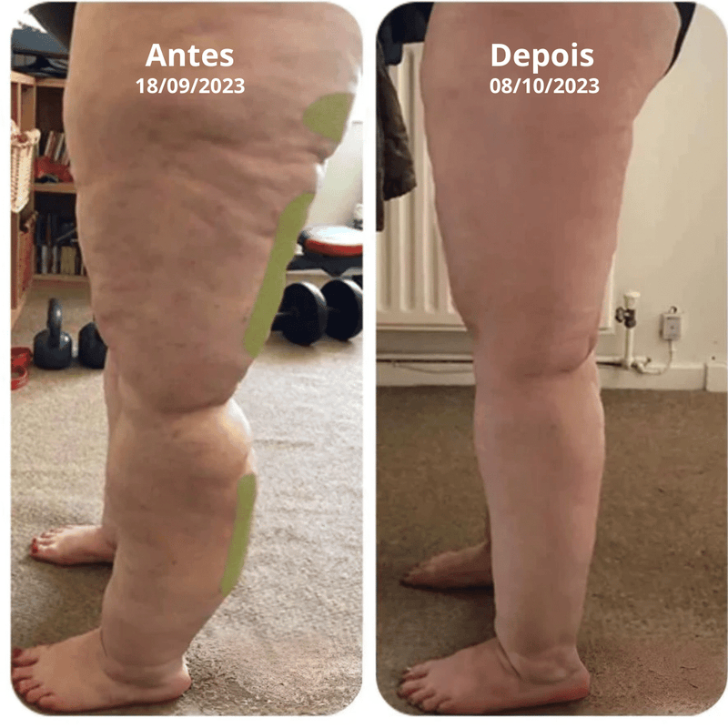 Adesivos HerbalDetox™ - Elimine Impurezas Do Corpo. 30 Unidades Reutilizáveis - Galeria desconto 